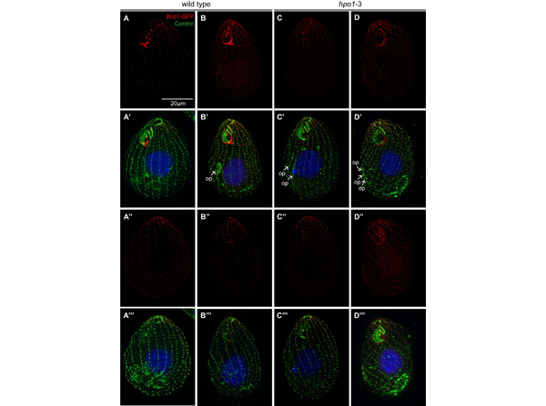 Immunofluorescence using GFP