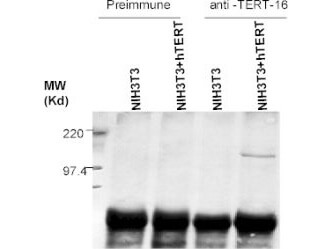Anti-hTERT Antibody  - Immunoprecipitation/Western Blot