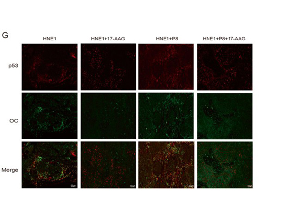 Immunofluorescence using Beta Amyloid