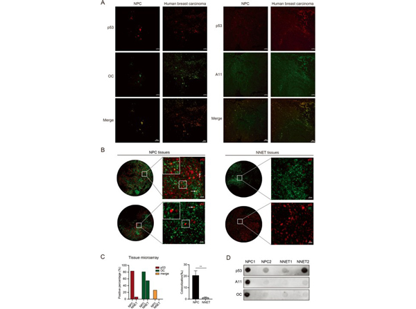 Immunofluorescence using Beta Amyloid