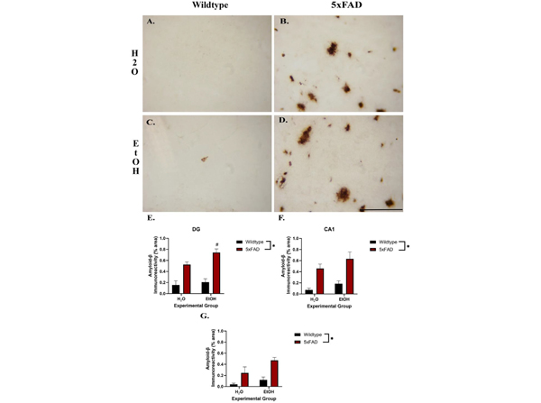 Immunohistochemistry using Beta Amyloid