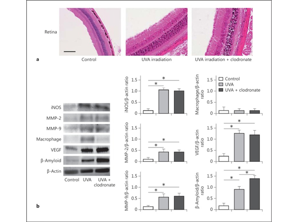 Western Blot using Beta Amyloid