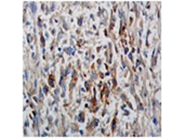 Immunohistochemistry of Anti-PhosphoTyrosine