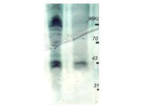 Anti-Phosphothreonine (pT) Antibody