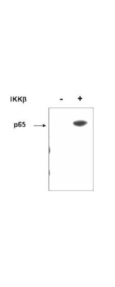 Anti-p65 (RelA) pS536 Antibody - Western Blot