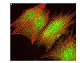 Anti-AKT pS473 Antibody - Immunofluorescence Confocal Microscopy