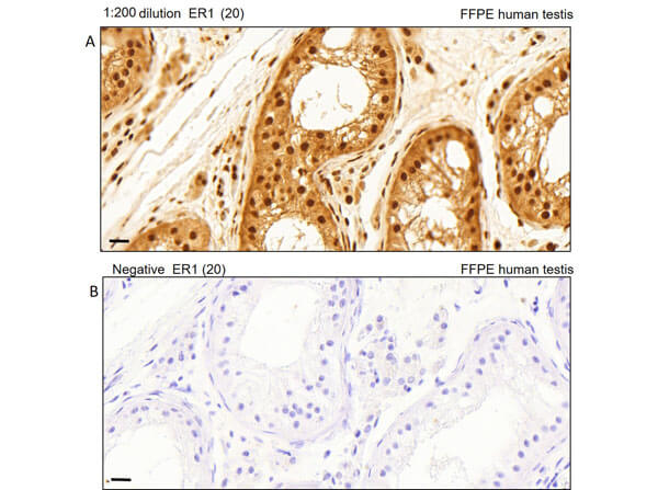 ELISA Results of Rabbit Anti-AKTpT308 Antibody