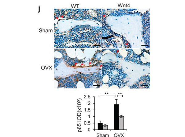 Immunohistochemistry using NFkB p65