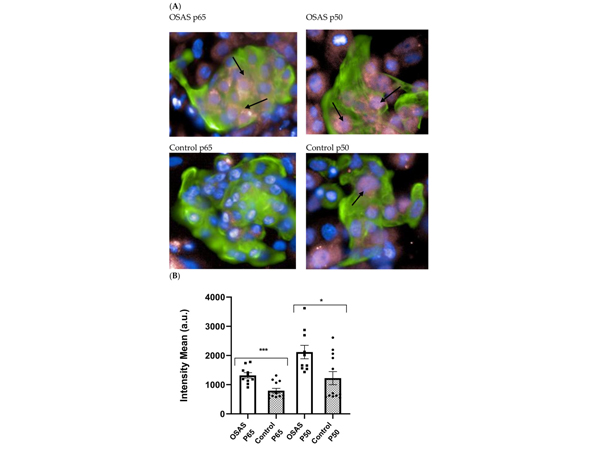 Immunofluorescence using NFkB p65