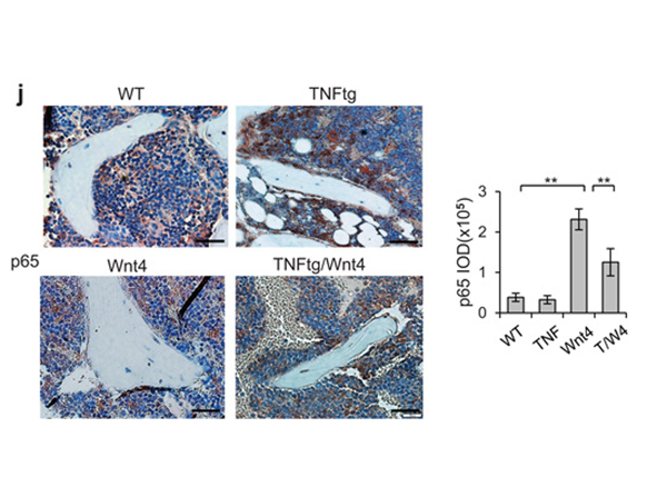 Immunohistochemistry using NFkB p65