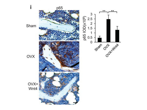 Immunohistochemistry using NFkB p65