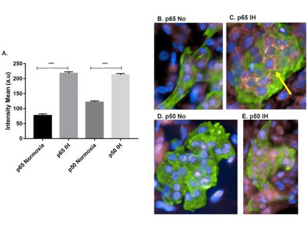 Immunofluorescence using NFkB p65