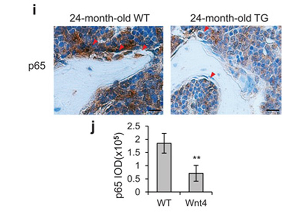 Immunohistochemistry using NFkB p65