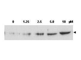 Anti-Chk2 pT68 Antibody - Western Blot