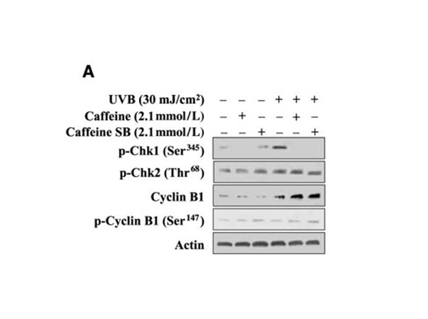 Western Blot using CHK2 pT68