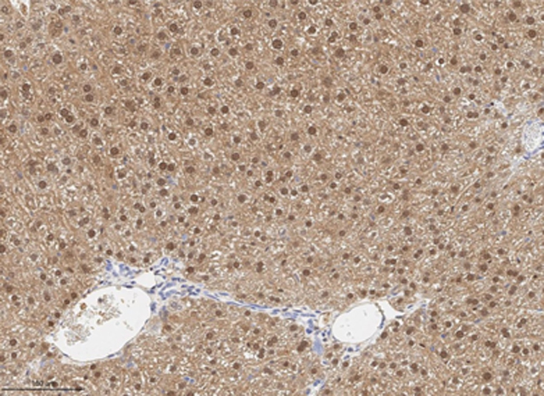 Immunohistochemistry using Rabbit Anti-RFP