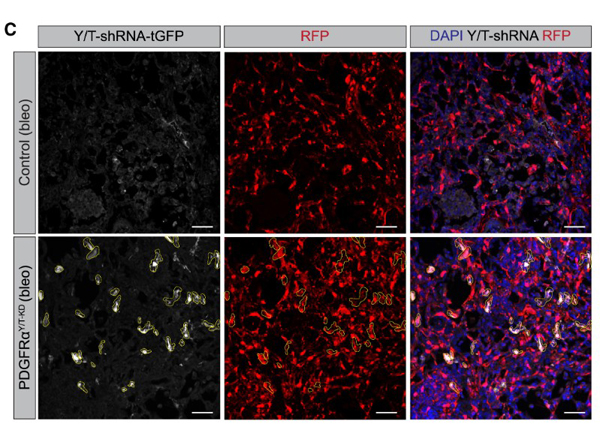Fluorescence using RFP