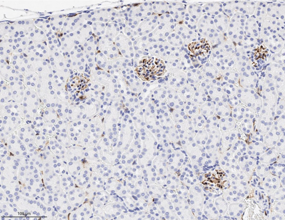 Immunohistochemistry using Rabbit Anti-RFP