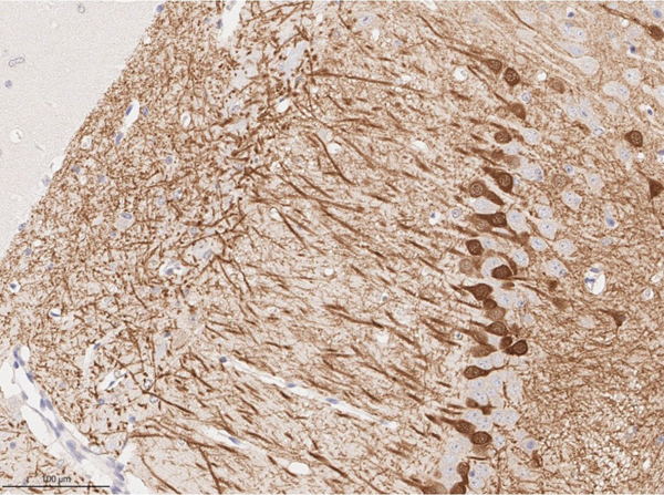 Immunohistochemistry using Rabbit Anti-RFP