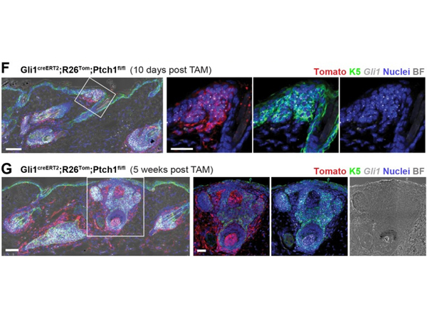 Fluorescence using RFP