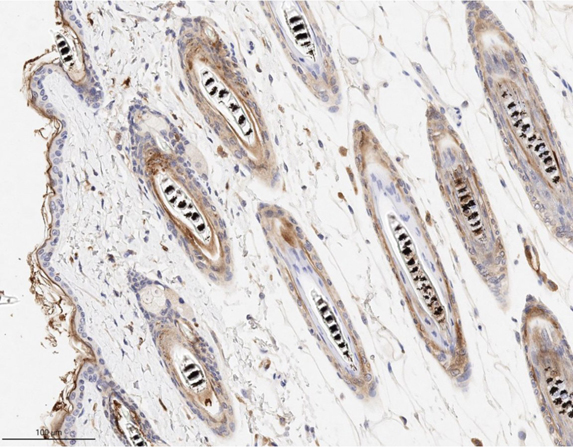 Immunohistochemistry using Rabbit Anti-RFP