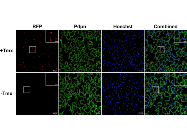 Fluorescence using RFP