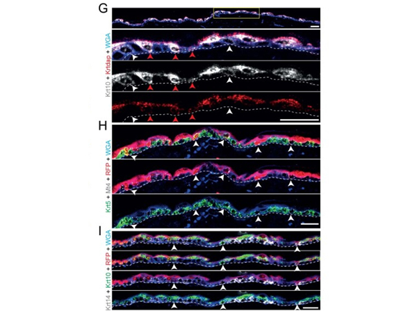 Fluorescence using RFP