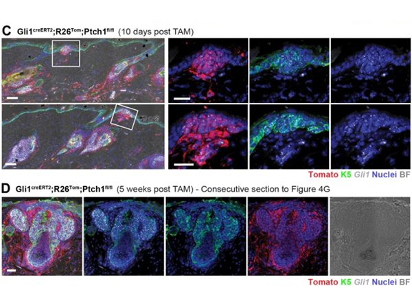 Fluorescence using RFP