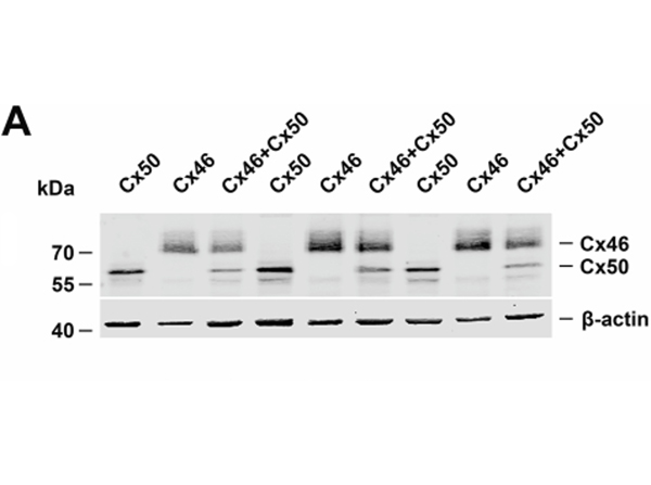 Western Blot using FLAG