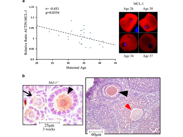 Immunohistochemistry using Mcl-1