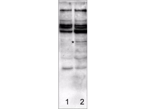 Anti-Caspase-2 Antibody - Western Blotting
