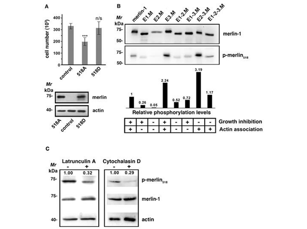 Western Blot using NF2 pS518
