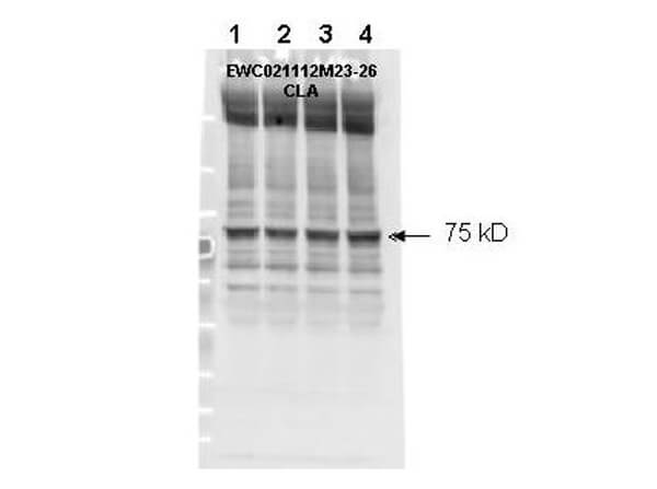 Anti-Human NF2 (Merlin) pS518 Antibody - Western Blot