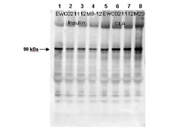 Western Blot of anti-human muscle Glycogen Synthase (GS) pS641