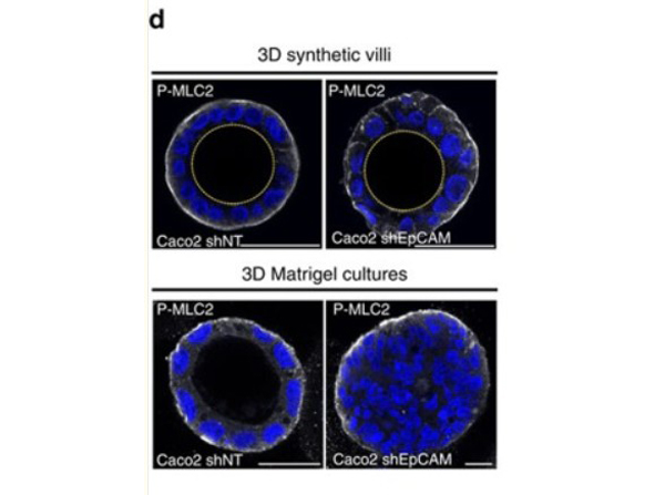 Immunofluorescence using pMLC