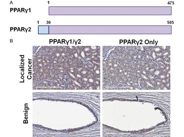Immunohistochemistry using PPAR gamma