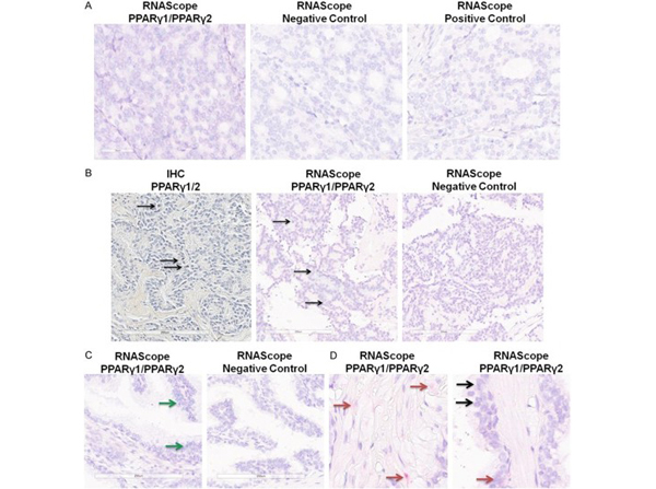 Immunohistochemistry using PPAR gamma