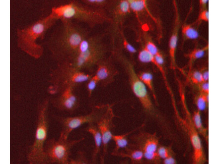 Immunofluorescence Microscopy - anti-PPAR alpha antibody.