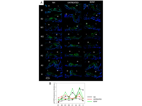 Immunofluorescence using mTOR pS2448