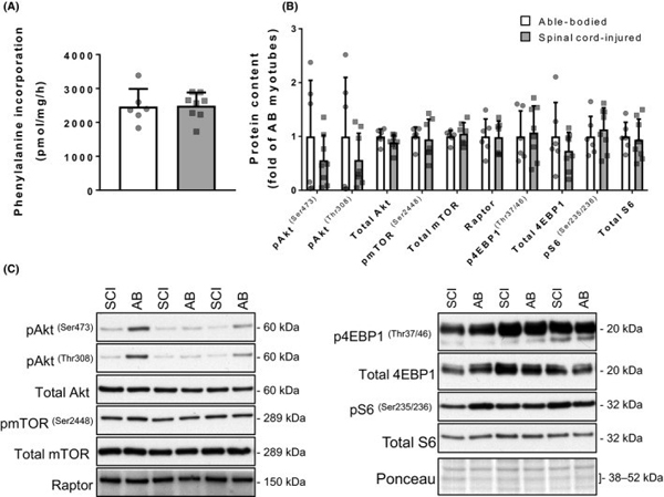 Western Blot using mTOR pS2448