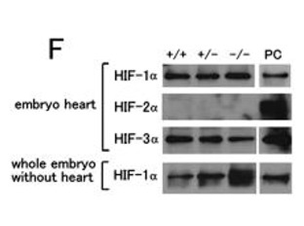 Western Blot using HIF3 alpha