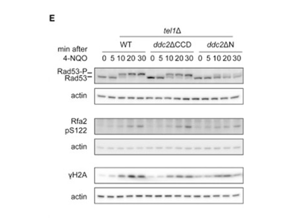 Western Blot using RFA1 pS122