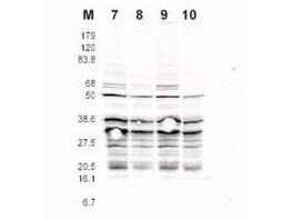 Anti-RFA2 pS122 Antibody - Western Blot