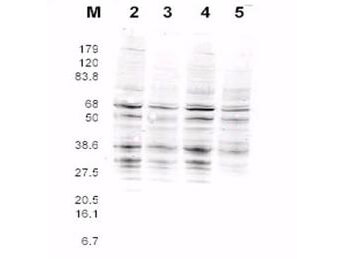 Anti-RFA2 Antibody - Western Blot