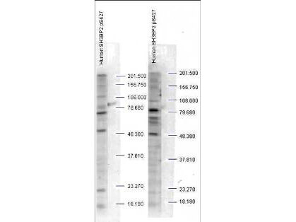 Anti-SH3BP2 pS427 Antibody - Western Blot