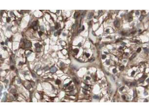 Anti-MAD2L2 Antibody - Immunohistochemistry