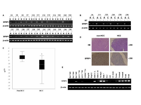 Western Blot using SFRP1