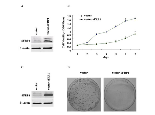 Western Blot using SFRP1