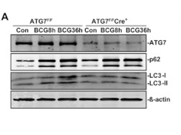Western Blot using APG7