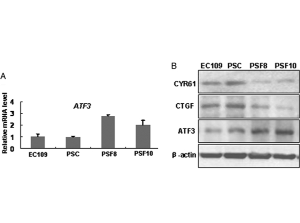 Western Blot using ATF3